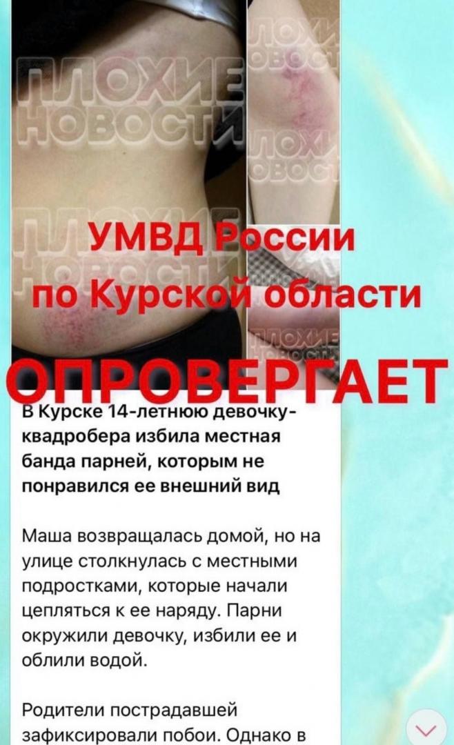 В Интернете активно распространяется фейк об избиении в Курской области девочки-квадробера | ГТРК «Курск» В Интернете активно распространяется фейк об избиении в Курской области девочки-квадробера